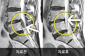 �ѹ�ġ�� �� ��ũ ������ ȯ�� ������� ��� 